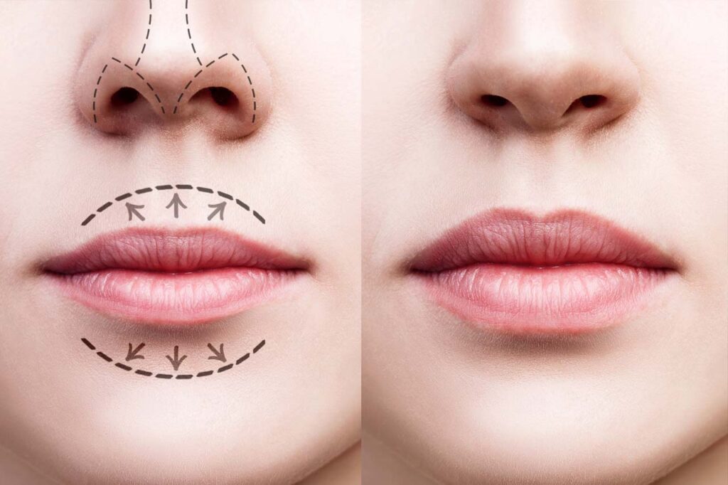 medicina estetica en Ibi